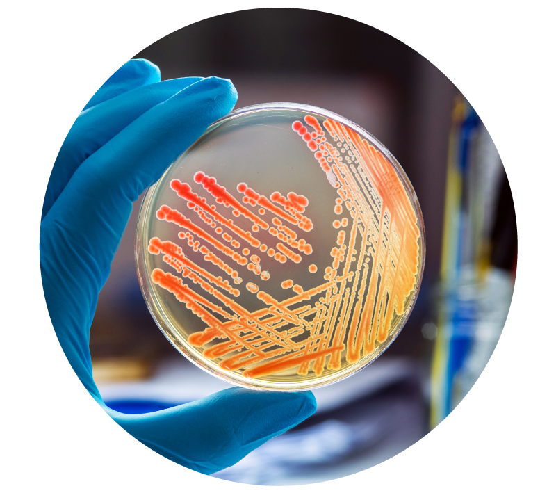 Análisis microbiológicos